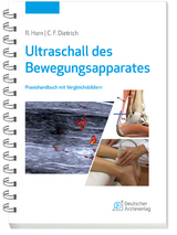 Ultraschall des Bewegungsapparates - Rudolf Horn, Christoph F. Dietrich