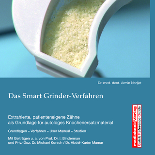 Das Smart Grinder-Verfahren