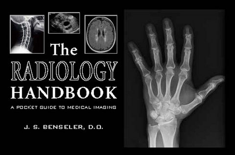 The Radiology Handbook - J. S. Benseler