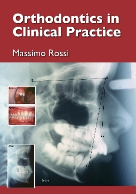 Orthodontics in Clinical Practice