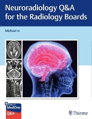 Neuroradiology Q&a for the Radiology Boards - Michael Iv