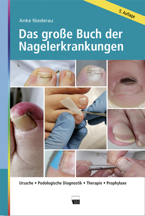 Das große Buch der Nagelerkrankungen - Anke Niederau