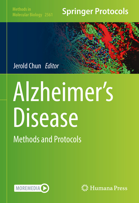 Alzheimer&rsquo;s Disease - 