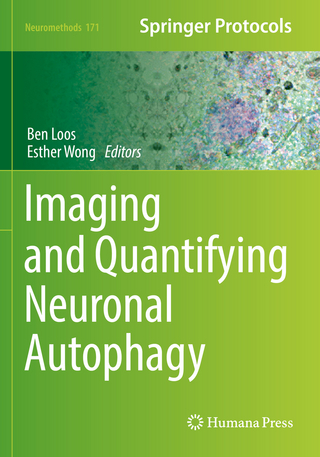 Imaging and Quantifying Neuronal Autophagy