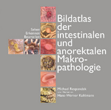 Bildatlas der intestinalen und anorektalen Makropathologie - Michael Respondek