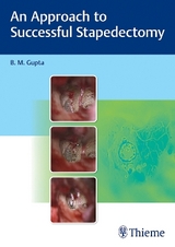 An Approach to Successful Stapedectomy - B Gupta