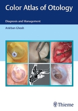 Color Atlas of Otology - Anirban Ghosh