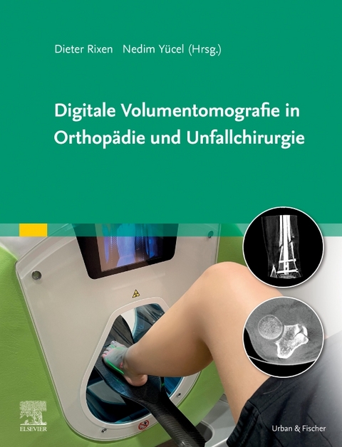 Digitale Volumentomografie in Orthop&auml;die und Unfallchirurgie - 
