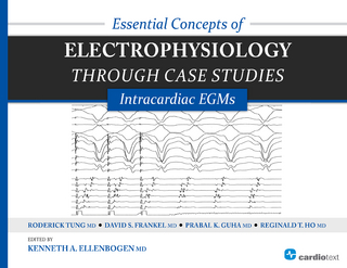 Essential Concepts of Electrophysiology through Case Studies: Intracardiac EGMs