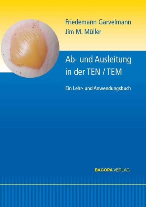 Ab- und Ausleitungsverfahren in der TEN/TEM. - Friedemann Garvelmann, Jim M. M&uuml;ller