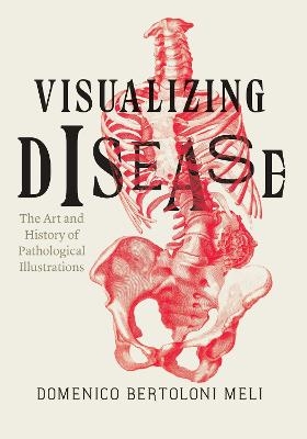 Visualizing Disease