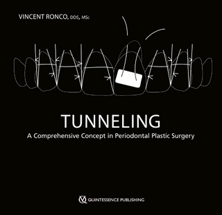 Tunneling