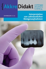 Interpretation zahnmedizinischer R&ouml;ntgenaufnahmen - Paul van der Stelt, Kostas Syriopoulos
