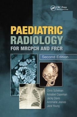 Paediatric Radiology for MRCPCH and FRCR, Second Edition - Christopher Schelvan, Copeman Copeman