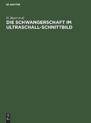 Die Schwangerschaft im Ultraschall-Schnittbild - H. Bayer, R. Schulte, P. Prenzlau, R. L&uuml;der