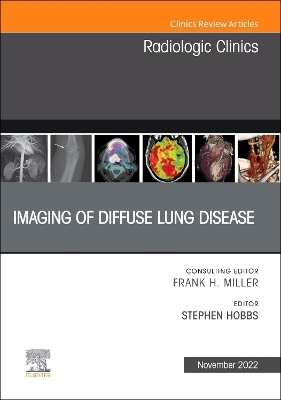Imaging of Diffuse Lung Disease, An Issue of Radiologic Clinics of North America