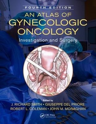 An Atlas of Gynecologic Oncology - 