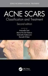 Acne Scars - Tosti, Antonella; De Padova, Maria Pia; Fabbrocini, Gabriella; Beer, Kenneth R