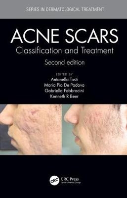 Acne Scars - 