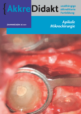 Apikale Mikrochirurgie - Fenneke Dommering