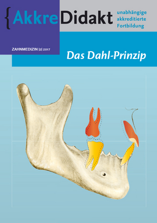 Das Dahl-Prinzip