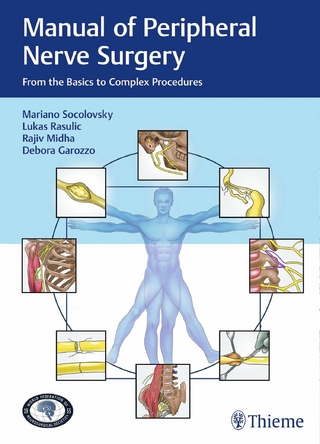 Manual of Peripheral Nerve Surgery