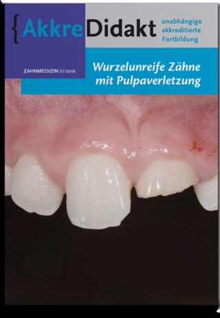 Wurzelunreife Zähne mit Pulpaverletzung