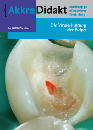 Die Vitalerhaltung der Pulpa