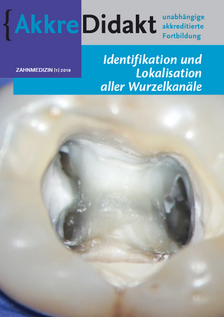 Identifikation und Lokalisation aller Wurzelkanäle
