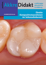 Direkte Kompositrestaurationen im Seitenzahnbereich - J&uuml;rgen Manhart