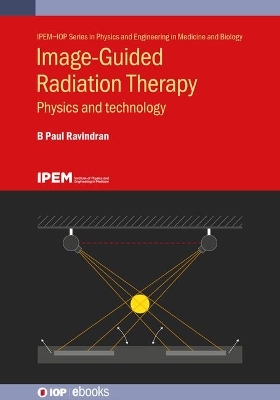 Image-Guided Radiation Therapy