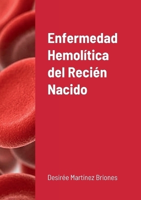 Enfermedad hemol&iacute;tica del Reci&eacute;n Nacido - Desir&eacute;e Mart&iacute;nez Briones