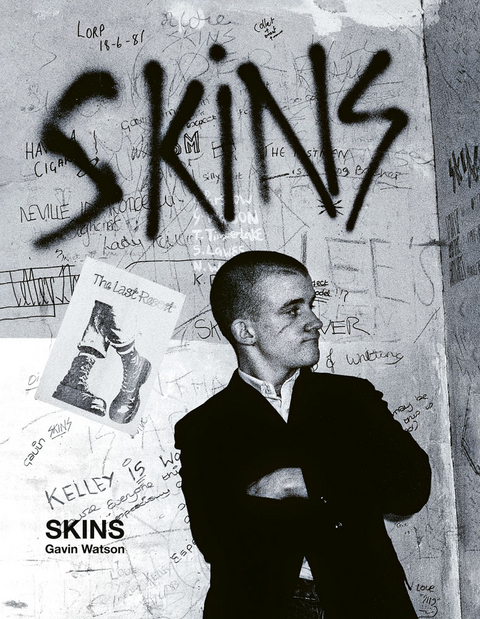 Skins - Gavin Watson