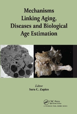 Mechanisms Linking Aging, Diseases and Biological Age Estimation