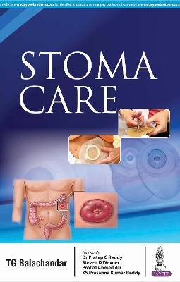 Stoma Care