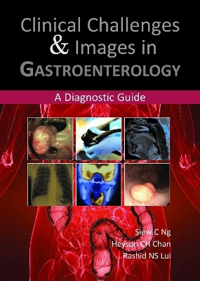 Clinical Challenges & Images in Gastroenterology - Dr Siew C Ng, Dr Heyson CH Chan, Dr Rashid NS Lui