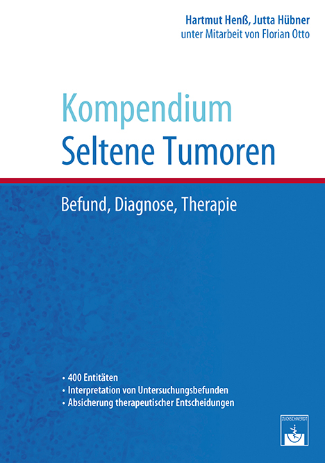 Kompendium Seltene Tumoren - Hartmut Henß, Jutta Hübner