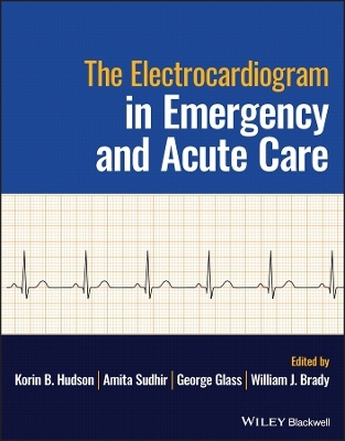 The Electrocardiagram in Emergency and Acute Care - 