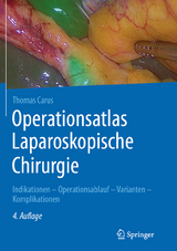 Operationsatlas Laparoskopische Chirurgie - Thomas Carus