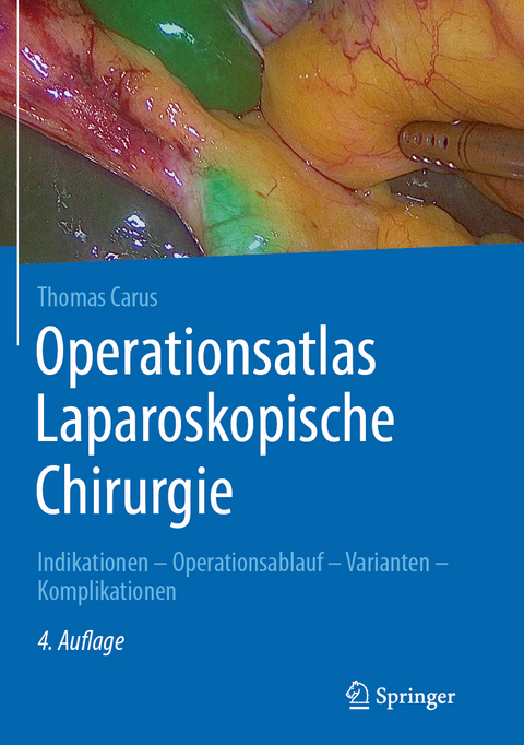 Operationsatlas Laparoskopische Chirurgie - Thomas Carus