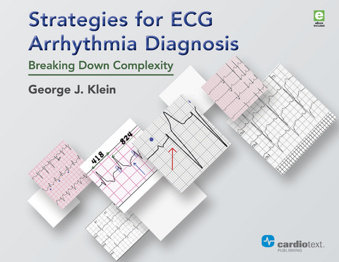 Strategies for ECG Arrhythmia Diagnosis - George J. Klein