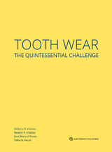 Tooth Wear - D&eacute;bora R. Vilaboa, Beatriz R. Vilaboa, Jose Manuel Reuss, D&eacute;bora Reuss