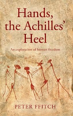 Hands, the Achilles’ Heel