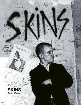 Skins - Special Edition - Gavin Watson