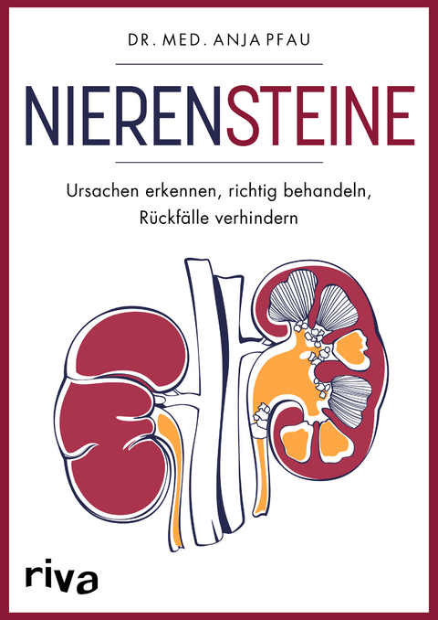 Nierensteine &ndash; Ursachen erkennen, richtig behandeln, R&uuml;ckf&auml;lle verhindern - Anja Pfau