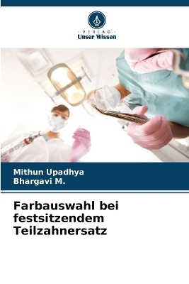 Farbauswahl bei festsitzendem Teilzahnersatz