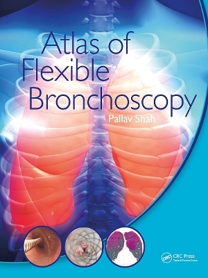 Atlas of Flexible Bronchoscopy - Pallav Shah