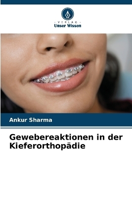 Gewebereaktionen in der Kieferorthop&auml;die - Ankur Sharma