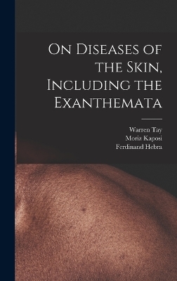 On Diseases of the Skin, Including the Exanthemata