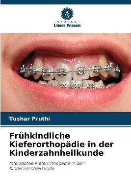 Frühkindliche Kieferorthopädie in der Kinderzahnheilkunde